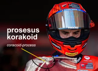 Histori Bahu Marc Marquez: Tantangan Fisik di Balik Misi Gelar Ke-10 Musim 2026